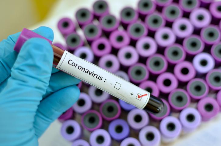 coronavirus5