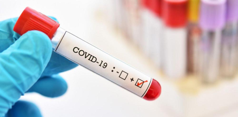 coronavirus positivo