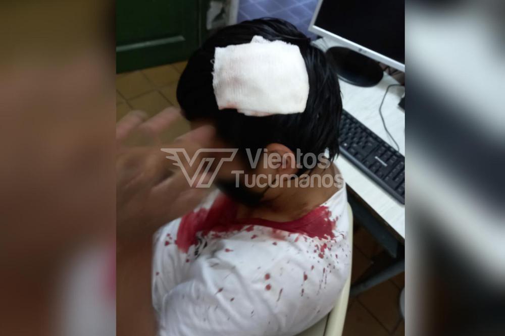 alumno robo sangre asalto
