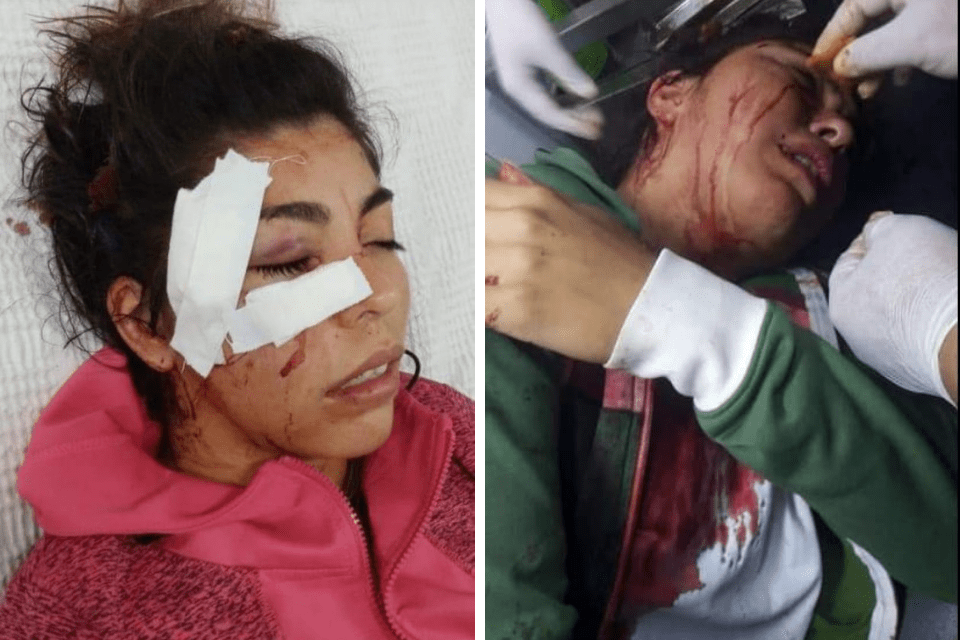 mujer agresion