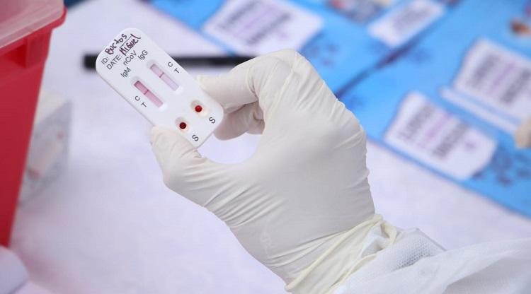 coronavirus3